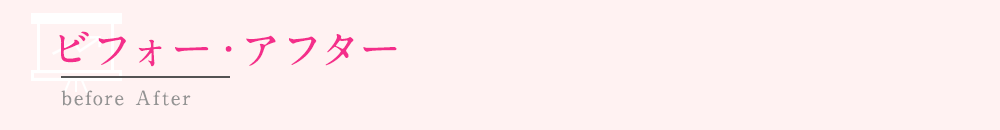 ビフォー・アフター